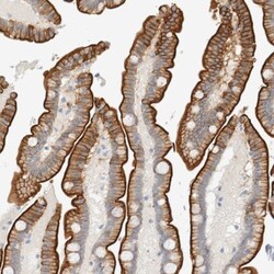Adipolin/FAM132A Antibody, Novus Biologicals 25 &mu;L; Unlabeled:Antibodies,